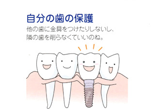 自分の歯の保護